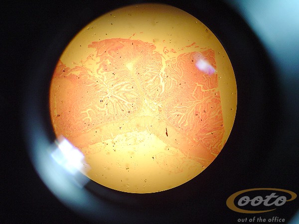 duodenoI