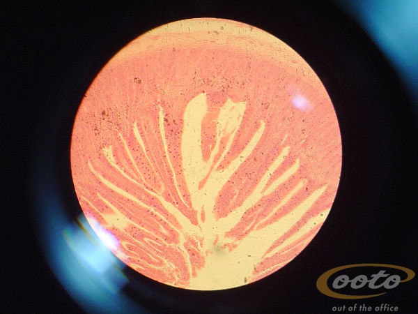 intestino delgaII