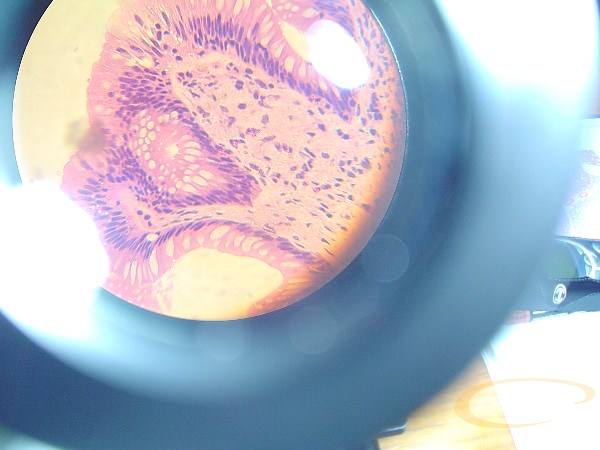 intestino grueso.rana.I