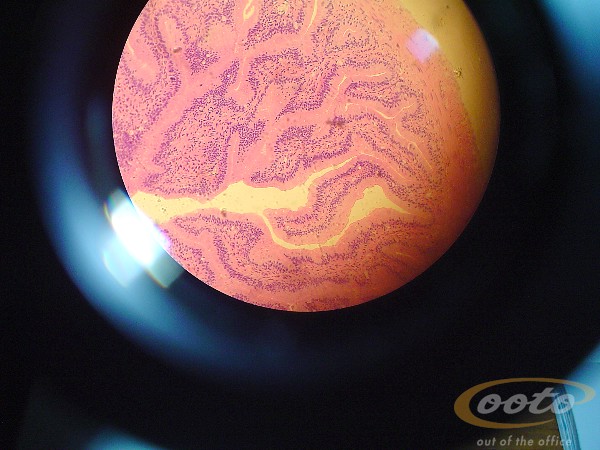 intestino.delgado.rana.II