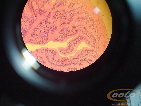 intestino.delgado.rana.III