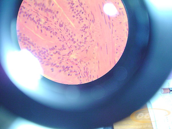 intestino.delgado.rana