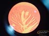 intestino delgaII