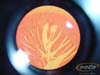 intestino delgaIII