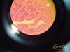 intestino.delgado.rana.III