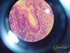 intestino.grueso.