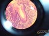 intestino.grueso.I